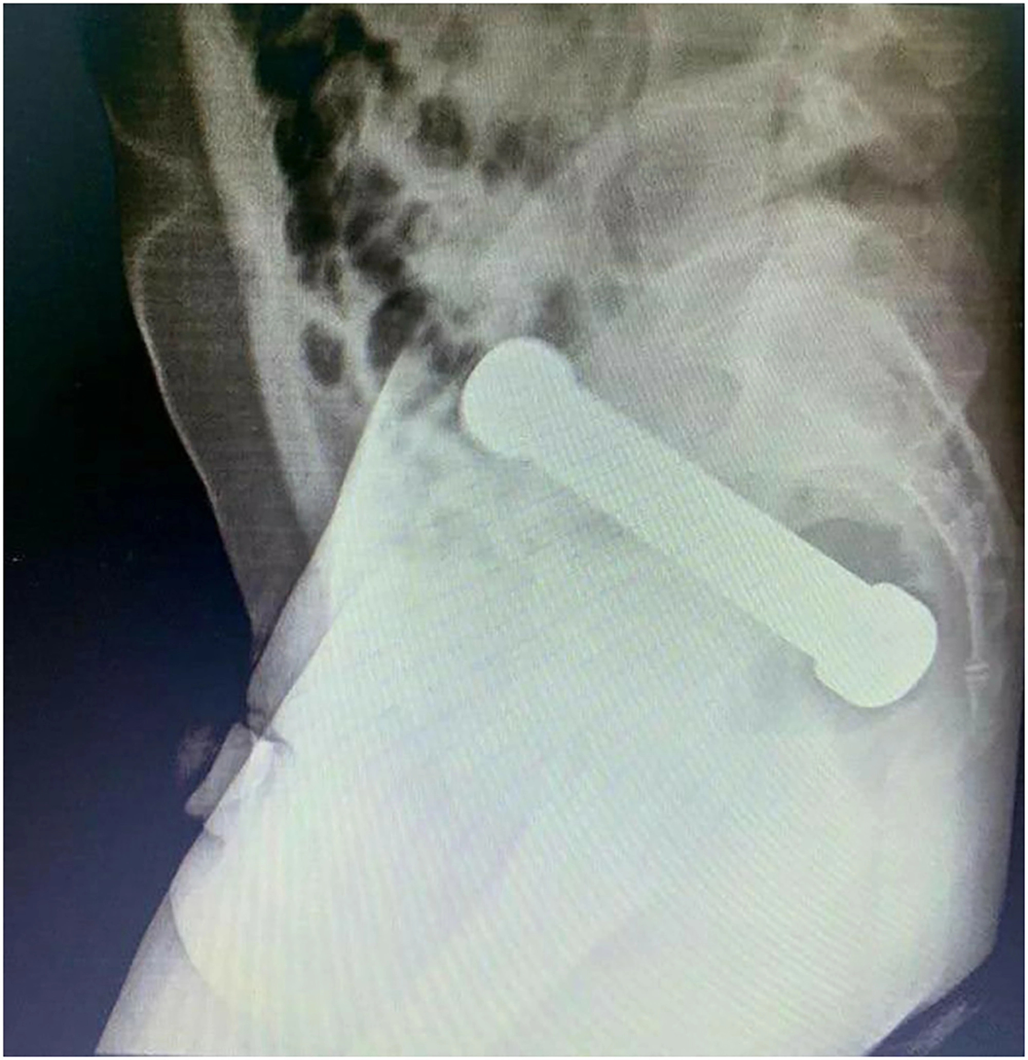 nude dildo x-ray