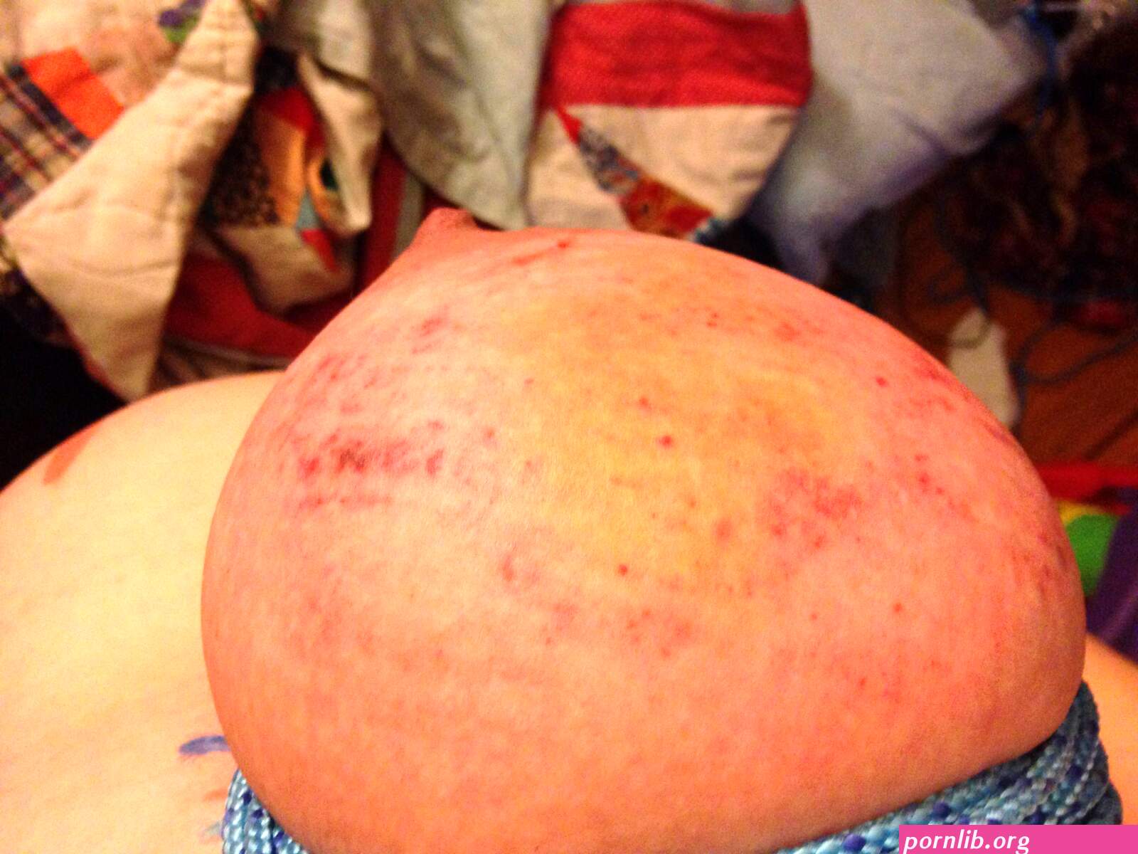 beaten bruises porn