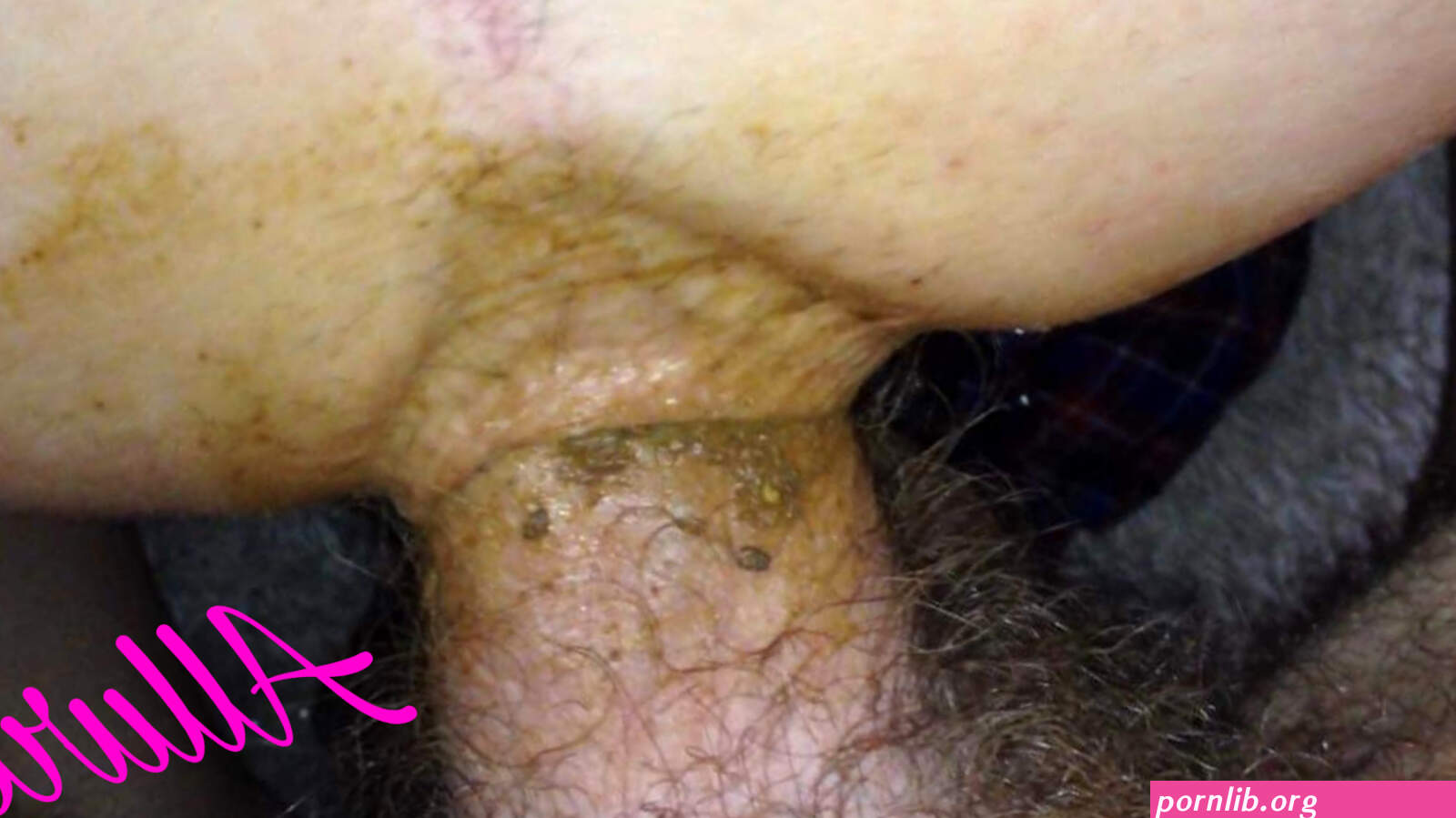 Dirty anal