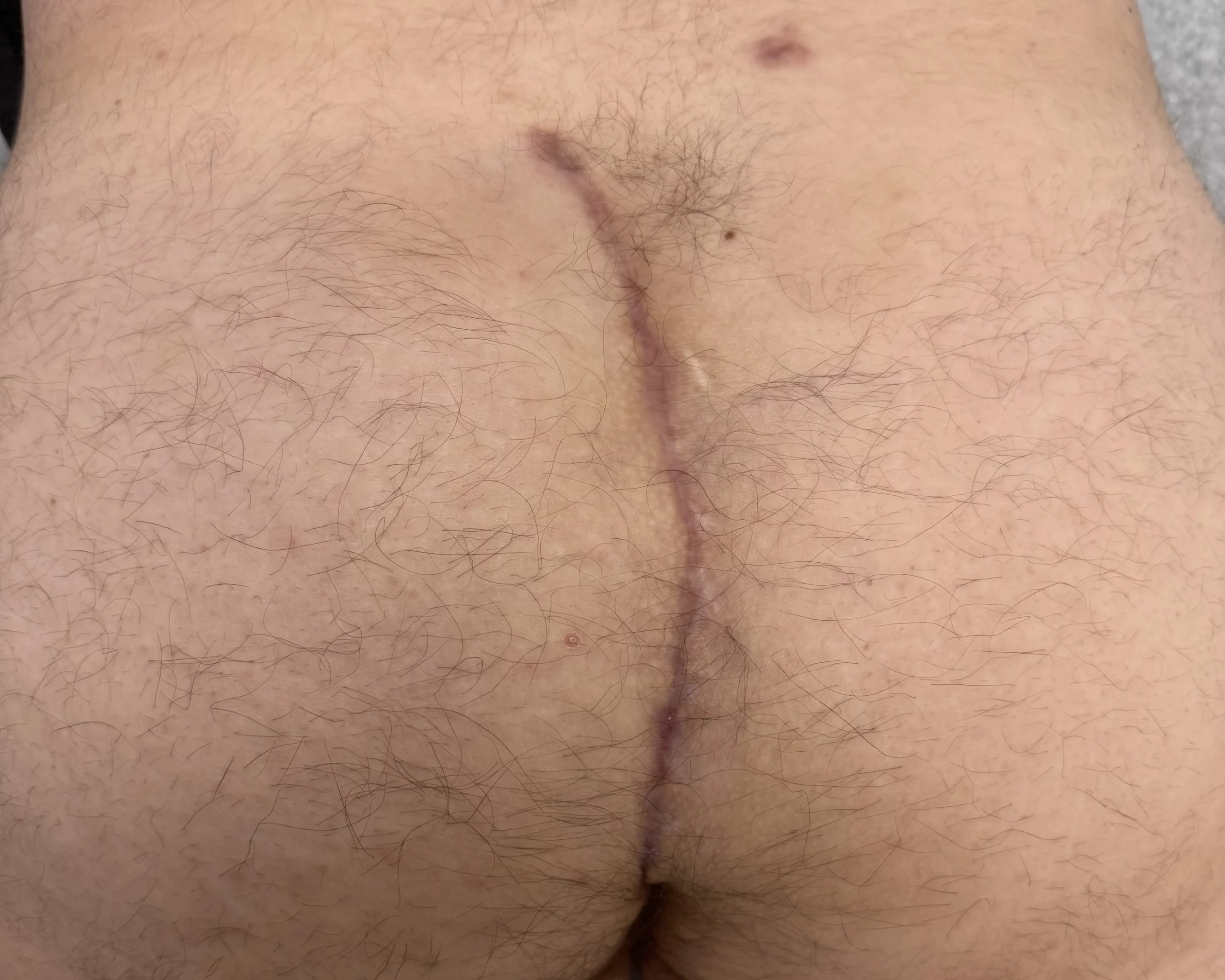 Porn: hairy anal pain
